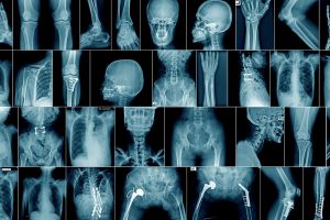 C 22 июля в клинике по адресу: ул.70 лет Октября,16/1 работает рентгеновский кабинет.